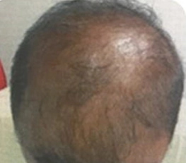 02-before