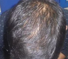 04-before