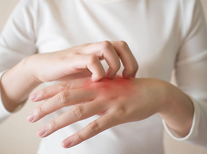Skin-Disorder-img