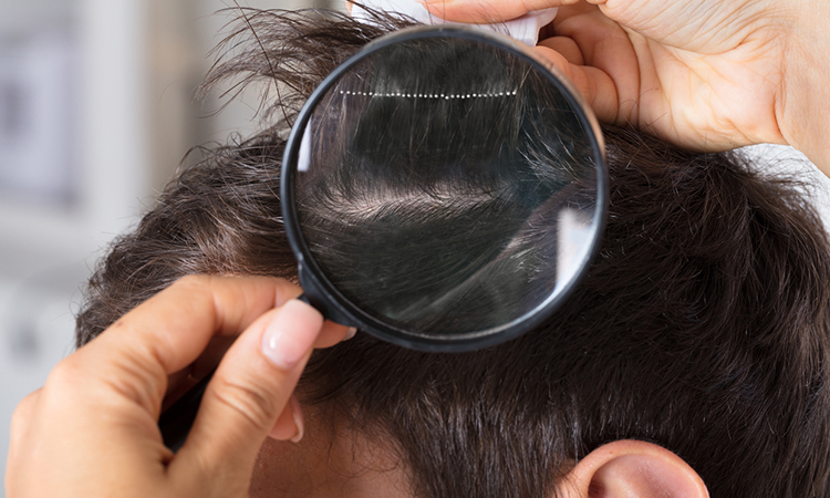 Customized and advanced solution for hair loss