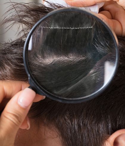 Customized and advanced solution for hair loss