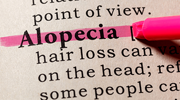 Alopecia Areata Causes