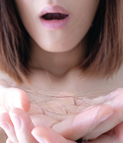 9 Triggers of Female Hair Loss