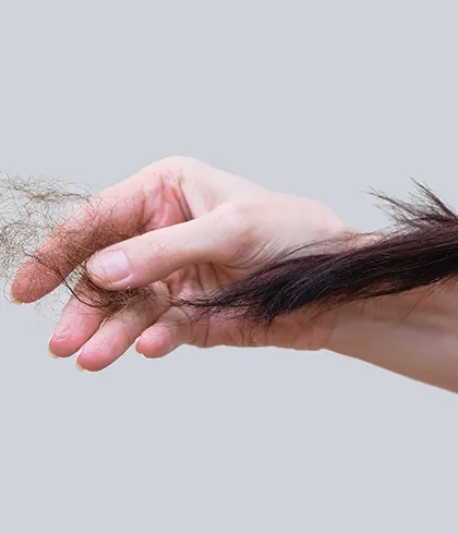 5 Best Hair loss treatments for Women 2022