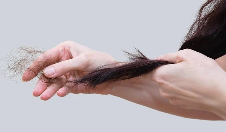 5 Best Hair loss treatments for Women 2022 | Dr Batra's™ Homeopathy in Dubai