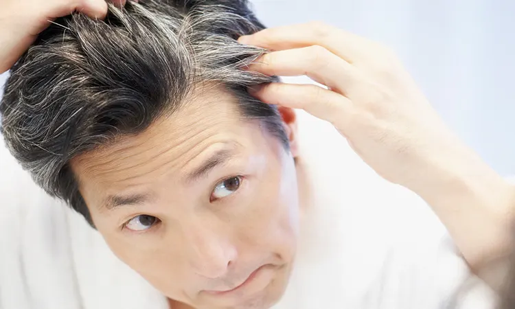 What Causes Premature Greying of Hair and Tips to Prevent it