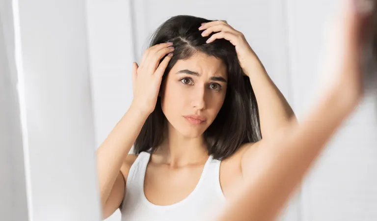 7 Natural Home Remedies for Dandruff and Itchy Scalp