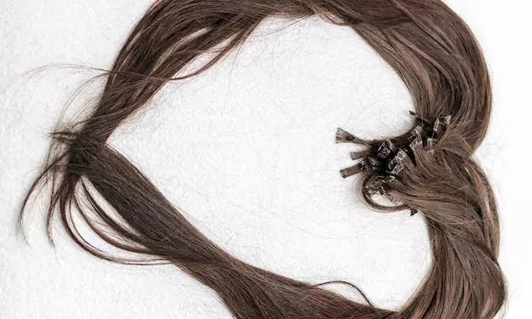 All that you need to know about your hair loss