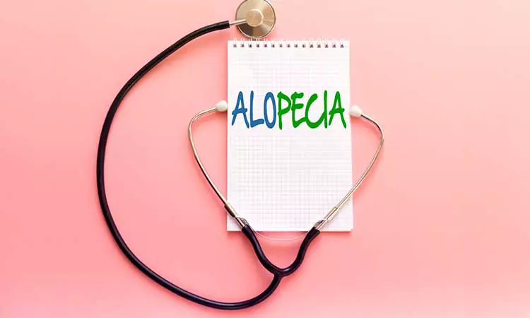 Alopecia Areata Treatment in Homeopathy