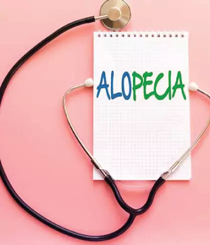 Alopecia Areata Treatment in Homeopathy