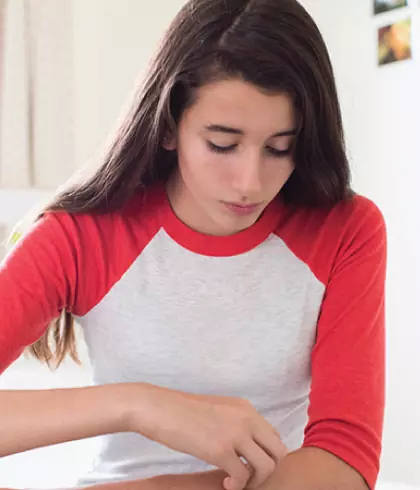 Eczema triggers you must avoid