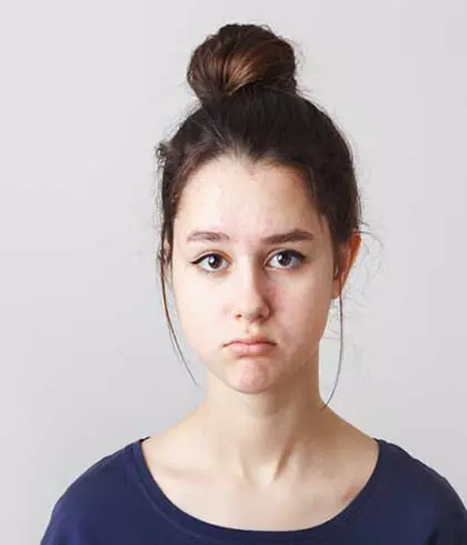 Teenage acne: when it’s time to see a doctor?