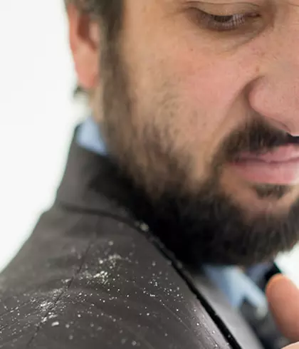 Don’t let dandruff ruin your relationship