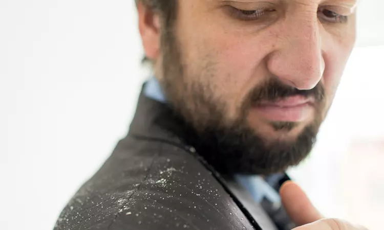 Don’t let dandruff ruin your relationship