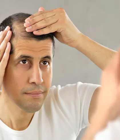 GENETIC HAIR LOSS IN MALES CAN BE TREATED