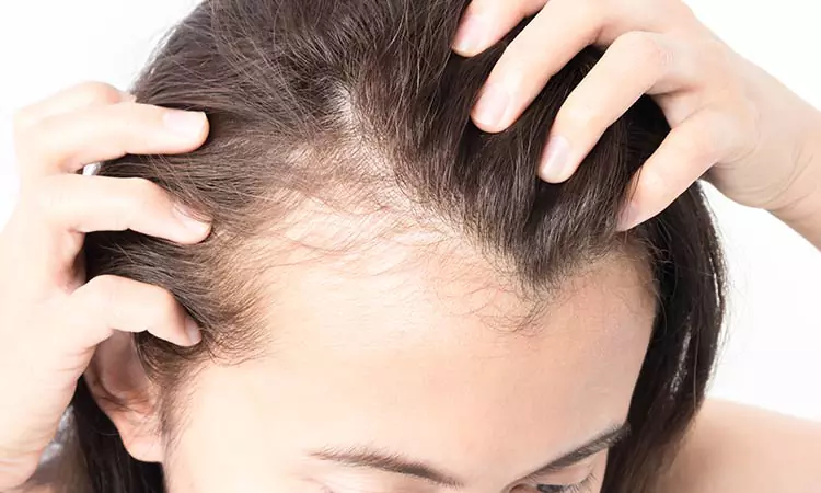 How to prevent thinning hair