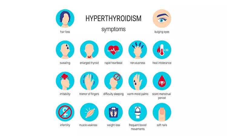 Hyperthyroidism