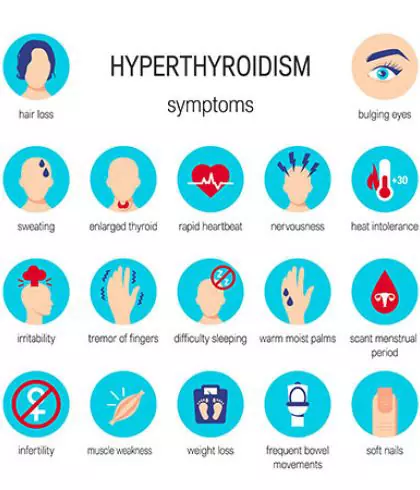 Hyperthyroidism