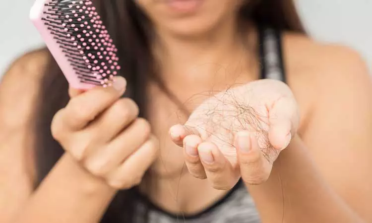 I have female pattern baldness. Can it be treated?