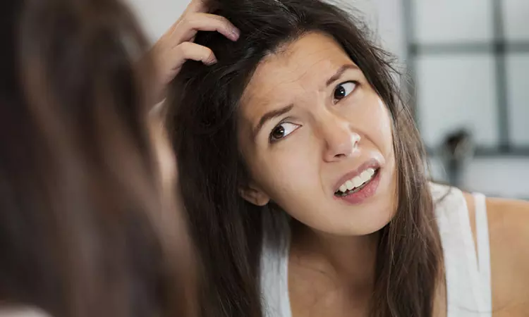 Itchy & scaly scalp? It can be psoriasis…