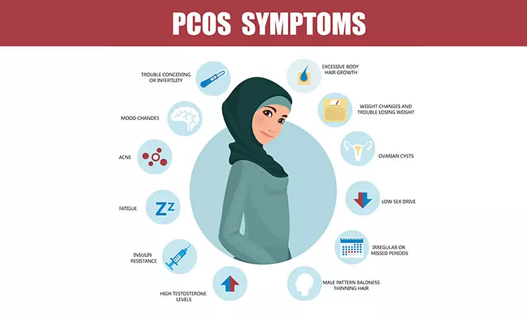 Symptoms and Treatment of PCOS