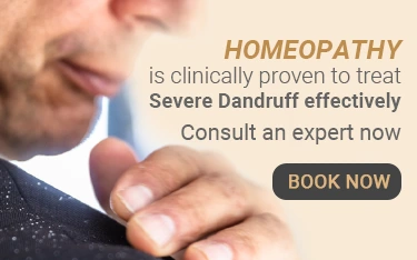 Dandruff Treatment - Dr Batras