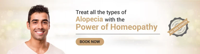 Alopecia Areata