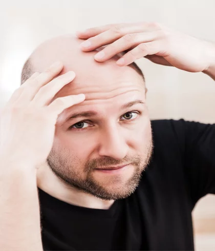 Can homeopathy cure genetic baldness?