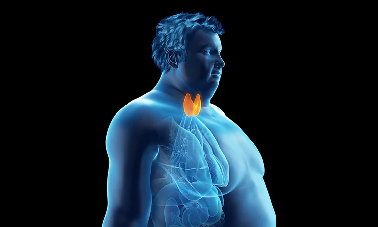 Tough time losing weight It could be due to thyroid problem
