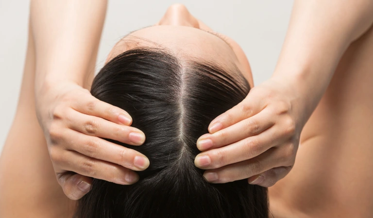 Take Control of Your Hair Fall: Expert Recommendations for a Healthier Scalp