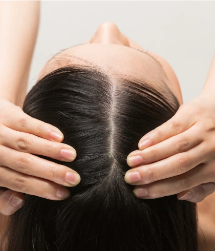 Take Control of Your Hair Fall: Expert Recommendations for a Healthier Scalp