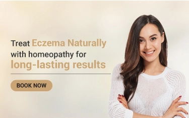 Eczema