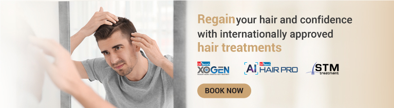 Baldness Treatment