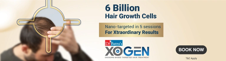 XOGen