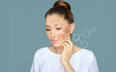 How to Get Rid of Hyperpigmentation Around Mouth?