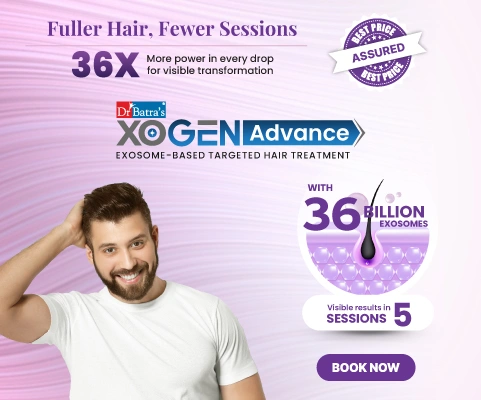 XOGEN Advance banner