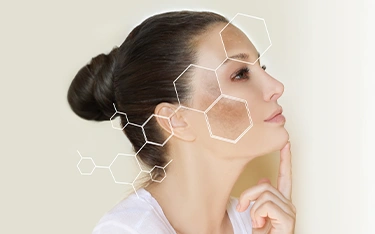 Pigmentation on the Face