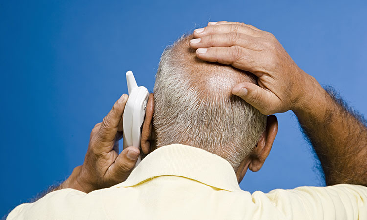 Alopecia