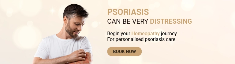 Scalp Psoriasis