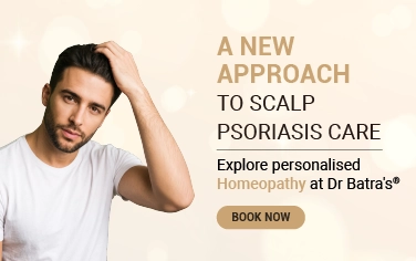 Scalp Psoriasis