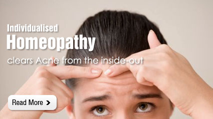 Homeopathy clears acne from the inside-out Homeopathy clears acne from the inside-out