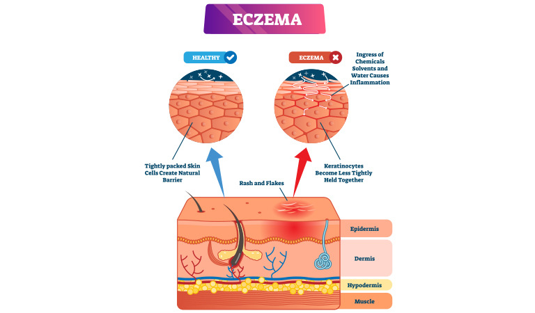 Moisturize your skin after exfoliation