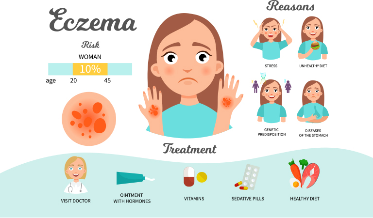 Chronic Eczema