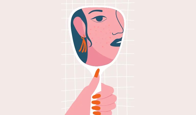 Everything You Need to Know About Treating Hormonal Acne