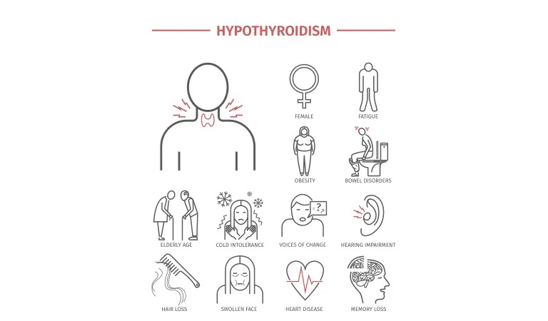 Thyroid Hair Fall Solution: How to Take Care of Hair Loss in Hypothyroidism