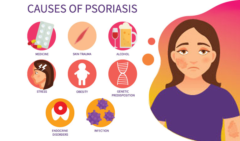 Scalp Psoriasis: Is there any cure for psoriasis in homeopathy