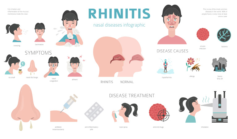 What is rhinitis? What are its causes and symptoms?