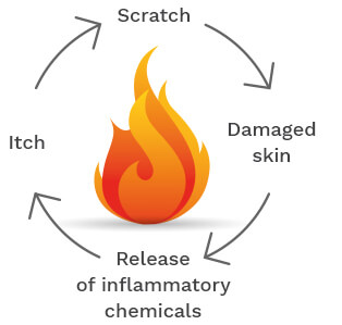 common-system-exzema-1