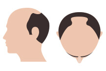 hair-thumb-step-10