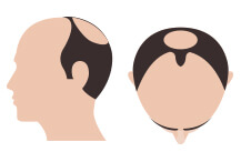 hair-thumb-step-11
